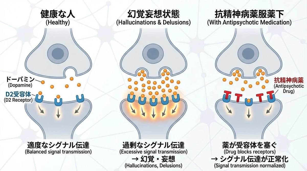 Dopamine Synapse Schizophrenia Diagram